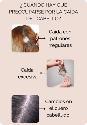 ¿ cuándo hay que preocuparse por la caída del cabello?